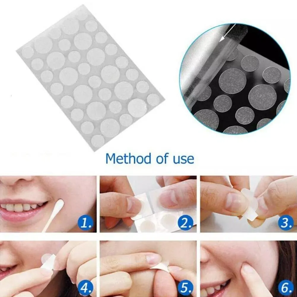 3-piece Acne Treatment Set for Scars and Pimples