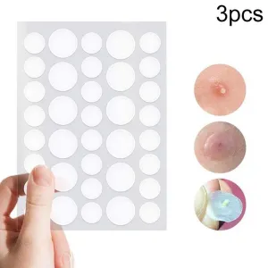 3-piece Acne Treatment Set for Scars and Pimples