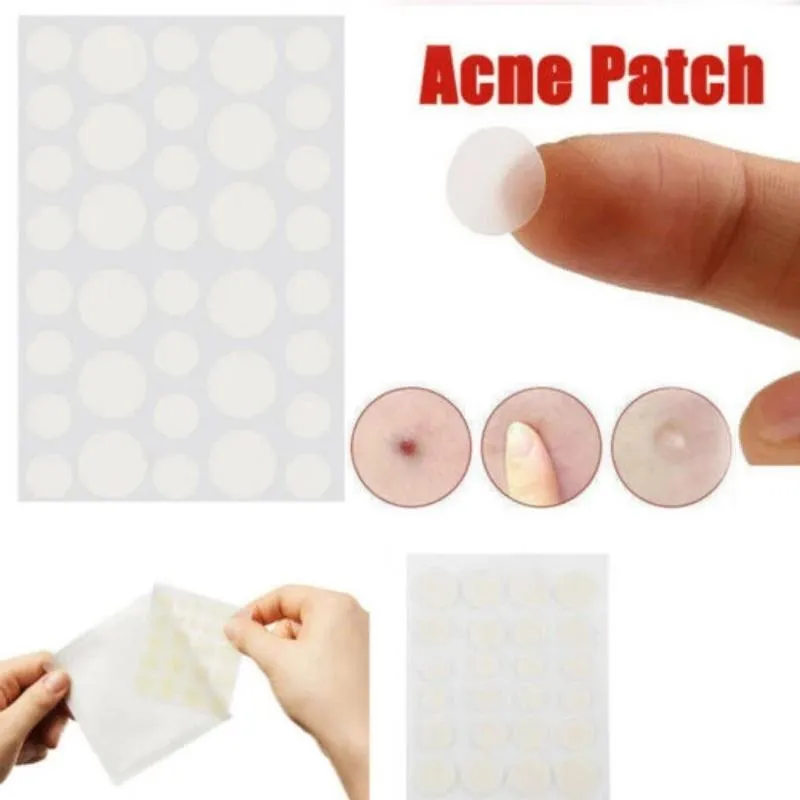 3-piece Acne Treatment Set for Scars and Pimples