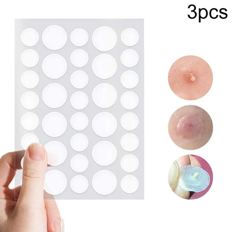 3-piece Acne Treatment Set for Scars and Pimples